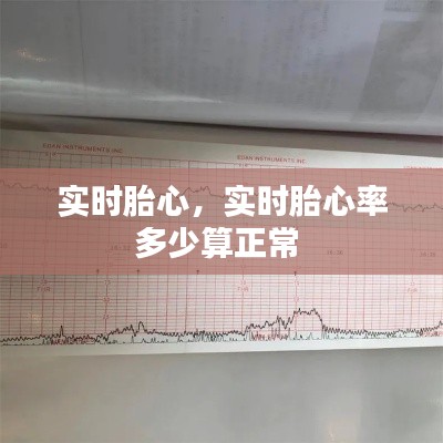 實時胎心，實時胎心率多少算正常 