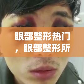 眼部整形熱門(mén)，眼部整形所有項(xiàng)目 