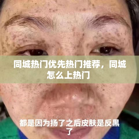 同城熱門優(yōu)先熱門推薦，同城怎么上熱門 