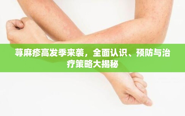 蕁麻疹高發(fā)季來(lái)襲，全面認(rèn)識(shí)、預(yù)防與治療策略大揭秘