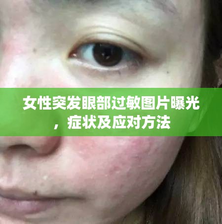 女性突發(fā)眼部過敏圖片曝光，癥狀及應(yīng)對方法
