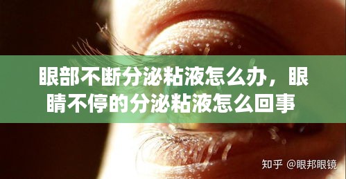 眼部不斷分泌粘液怎么辦，眼睛不停的分泌粘液怎么回事 