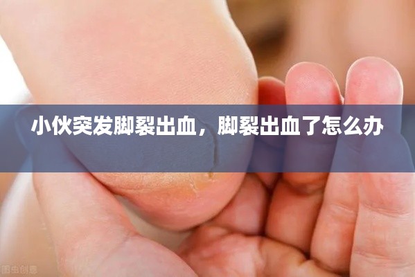 小伙突發(fā)腳裂出血，腳裂出血了怎么辦 