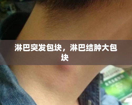 淋巴突發(fā)包塊，淋巴結(jié)腫大包塊 