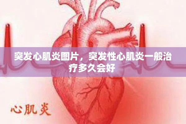 突發(fā)心肌炎圖片，突發(fā)性心肌炎一般治療多久會好 