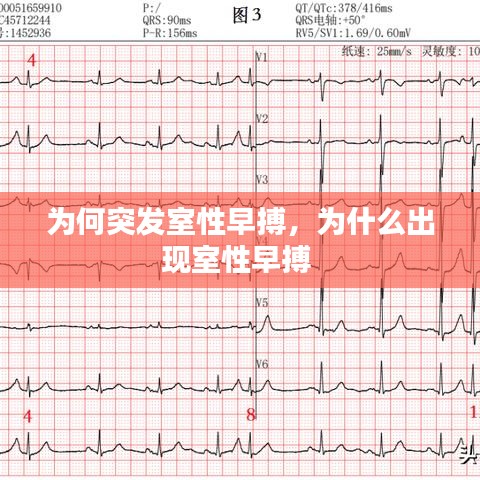 為何突發(fā)室性早搏，為什么出現(xiàn)室性早搏 
