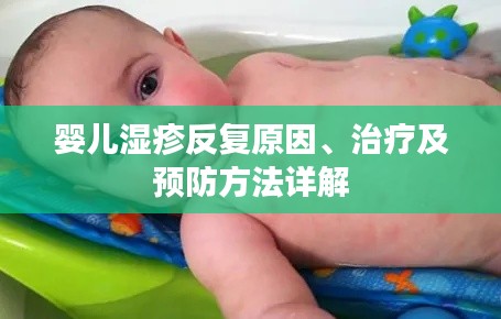 嬰兒濕疹反復原因、治療及預(yù)防方法詳解