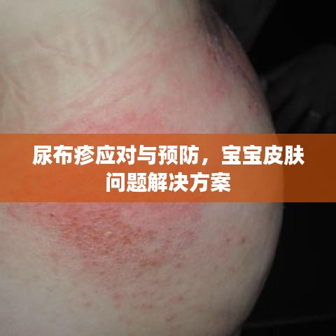 尿布疹應(yīng)對與預(yù)防，寶寶皮膚問題解決方案