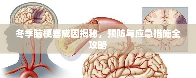 冬季腦梗塞成因揭秘，預(yù)防與應(yīng)急措施全攻略