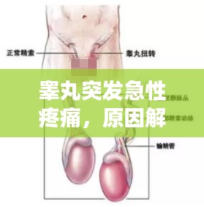 睪丸突發(fā)急性疼痛，原因解析、應(yīng)急處理與預(yù)防策略