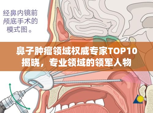 鼻子腫瘤領(lǐng)域權(quán)威專家TOP10揭曉，專業(yè)領(lǐng)域的領(lǐng)軍人物