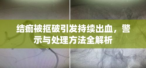 結(jié)痂被摳破引發(fā)持續(xù)出血，警示與處理方法全解析