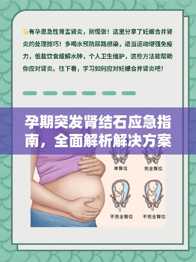 孕期突發(fā)腎結(jié)石應(yīng)急指南，全面解析解決方案